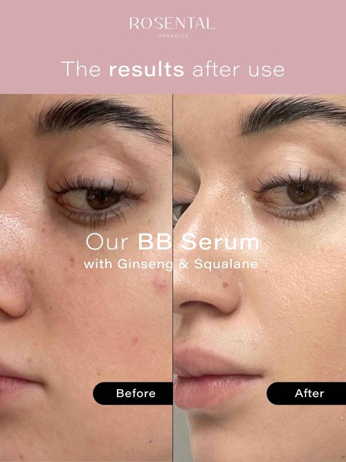 Rosental Organics BB Serum with Squalane & Ginseng – Hydrating Tinted Serum for Face, Anti-Aging Lightweight Skin Tint Moisturizer, Natural Makeup with Glow, Light Coverage Foundation, Medium