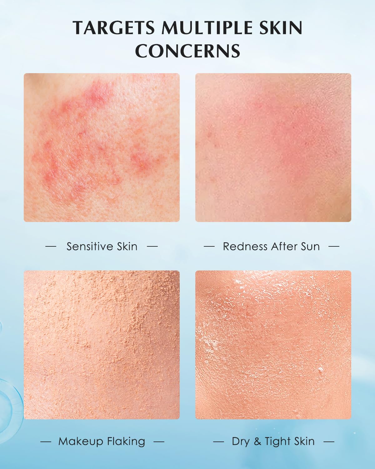 KOMFYMED Recombinant Collagen Restoration One-Day Serum – 4 Types of Collagen & Ectoin, Intensive Barrier Strengthening & Hydration, Single-Use Vials for All Skin Types (1.5ml / 0.05 fl.oz × 30)