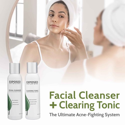 Exposed Skin Care, Acne Treatment Kit with 2.5% Salicylic Acid and 3.5% Benzoyl Peroxide to Clear Up Teen, Adult, Hormonal and Cystic Acne – Natural, Non-toxic and Cruelty Free