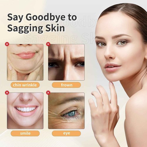 Elves Threads Lift for Face Whole Body Lifting/Screw Mono Threads for Eye lift/Protein Threads for Face/ 20pcs