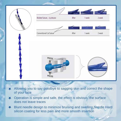Oldream Pdo Cog Threads, Pdo Fishbone Thread 18G100MM, W-Type, 20pcs