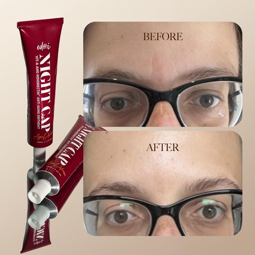 edandi NIGHT CAP Facial Night Cream with Vitamin A, and NovoRetin Anti Aging Ointment to Minimize Appearance of Wrinkles and Fine Lines, 1.69 oz