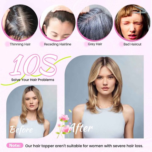 YAMI Hair Toppers for Women Fluffy Human Hair Topper 10inch Handmade Swiss Base Hairpieces 360° Cover Hairloss (Medium Brown with Highlight)