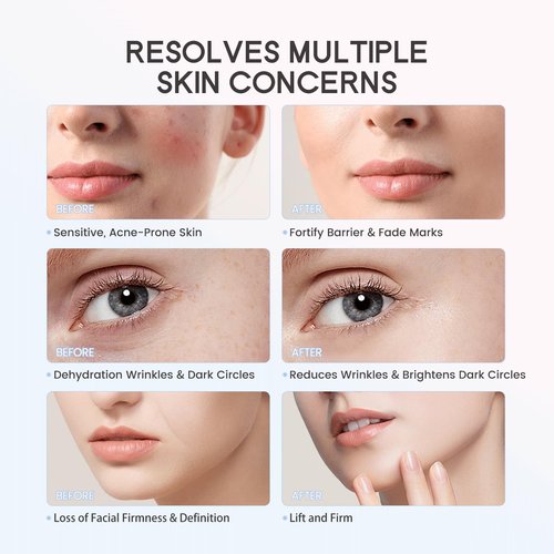 LULUROSE Facial Massager with Cold Heat Light Vibrating for Face,5-in-1 Facial Device with LED Display for Skin Care Wrinkles at Home Traveling,1500mAh