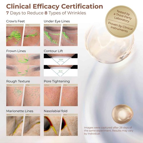 CHANDO HIMALAYA Extravagance Rejuvenation Collagen Cream (55g/1.94oz) - Collagen Anti Aging Face Cream Moisturizer for Boosts Skin Renewal and Collagen Replenishment