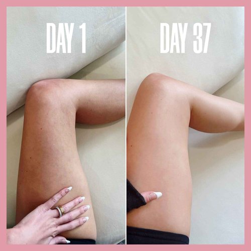 MAELYS THE CELLULITE & SAGGY SKIN DUO