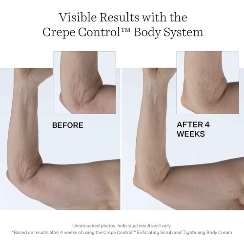 StriVectin Crepe Control Tightening Body Cream Jumbo, 10 oz, Body Cream for Hydration and Soft, Smooth Skin