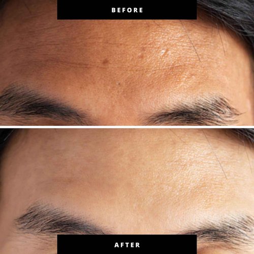 Kiierr Red & Blue Light Therapy for Face and Neck, Beauty Wand with Dual Light and Infared Modes