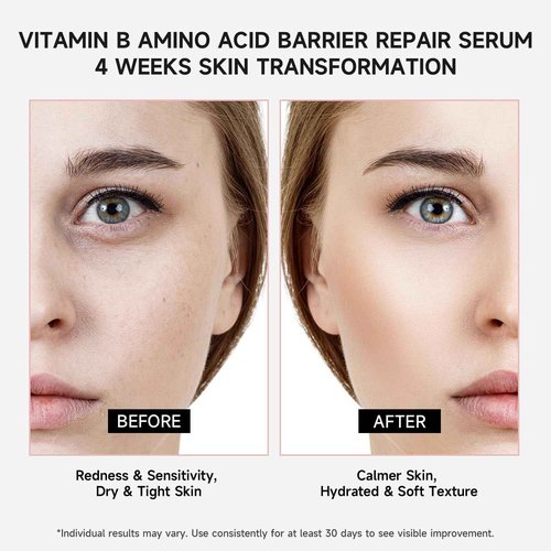 Vitamin B12 Serum for Face - Vitamin B Complex Ampoule with B12,B2,Glutathione,Hyaluronic Acid, Glycine&Arginine,Antioxidant Hydrating Face Serum for Dry,Sensitive Skin,1.2ml x 30