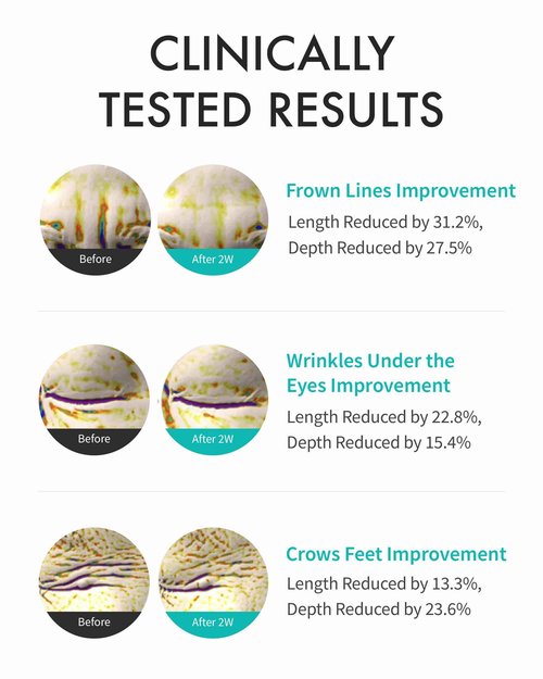 REJURAN® Intensive Eye Cream, c-PDRN® - Fast-Acting Eye Treatment for Wrinkles, Lifting, and Dark Circles. Instant Hydration and Visible Revitalization. Korean Skin Care (0.67 fl oz)