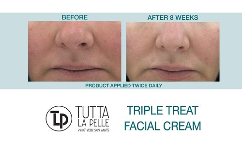 Tutta La Pelle Anti Aging face Cream TRIPLE Antioxidant Treatment Serum For Face, Resveratrol + Green Tea + Caffeine - Visibly Reduce Skin Redness & Calm Irritation -For Sensitive Rosacea Skin -1oz