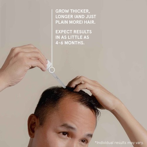 Keeps Starter Bundle - Includes Minoxidil Topical Hair Growth Solution, Hair Thickening Shampoo & Conditioner Set