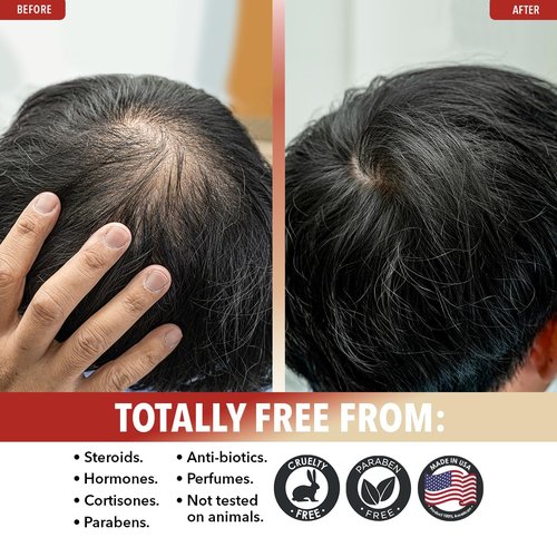 Dr. Robaina Organic Castor Oil – Cold-Pressed for Hair Growth, Eyelash & Eyebrow Care, Skin Hydration & Nail Strength – Pure Vegan Moisturizer – Made in USA, 4 oz