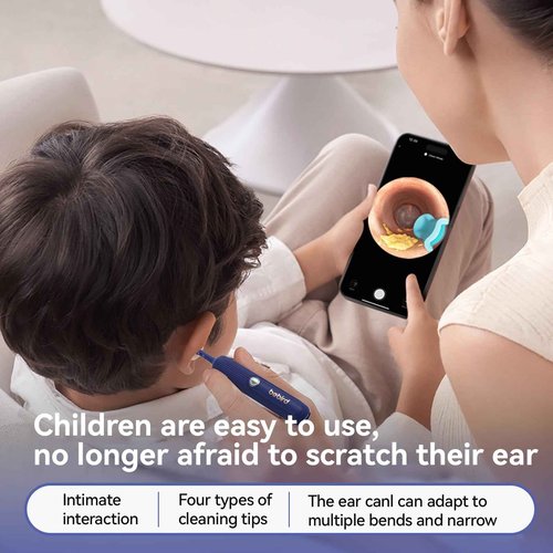 【Upgrade Version】Earsight Plus E33R Ear Wax Removal Tool Camera, Ear Cleaner with Flexible Ear Camera Otoscope, Visual Ear Pick Tweezers Wax Remover, Ear Cleaning Kit for Family