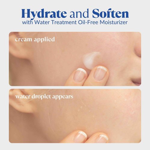 NATURAL AQUA GEL CURE Water Treatment Oil-Free Moisturizer + The Beauty 3-Step Skincare Kit