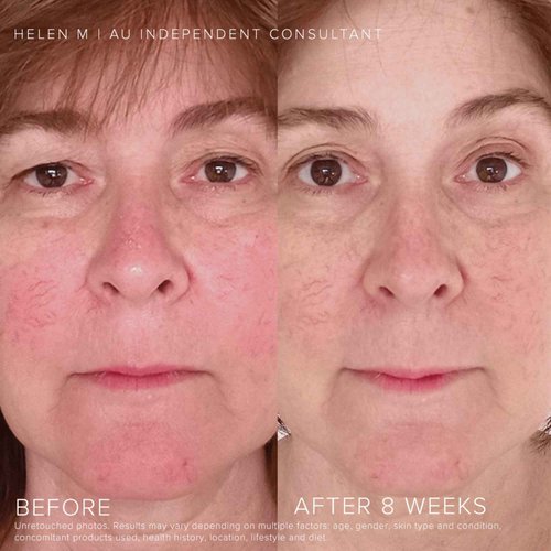 Rodan + Fields Soothe Daily Mineral Sunscreen SPF 30 | 1 Fl Oz | SPF Moisturizer for Face | Zinc Oxide Sunblock | Travel Size Sun Protection Skincare