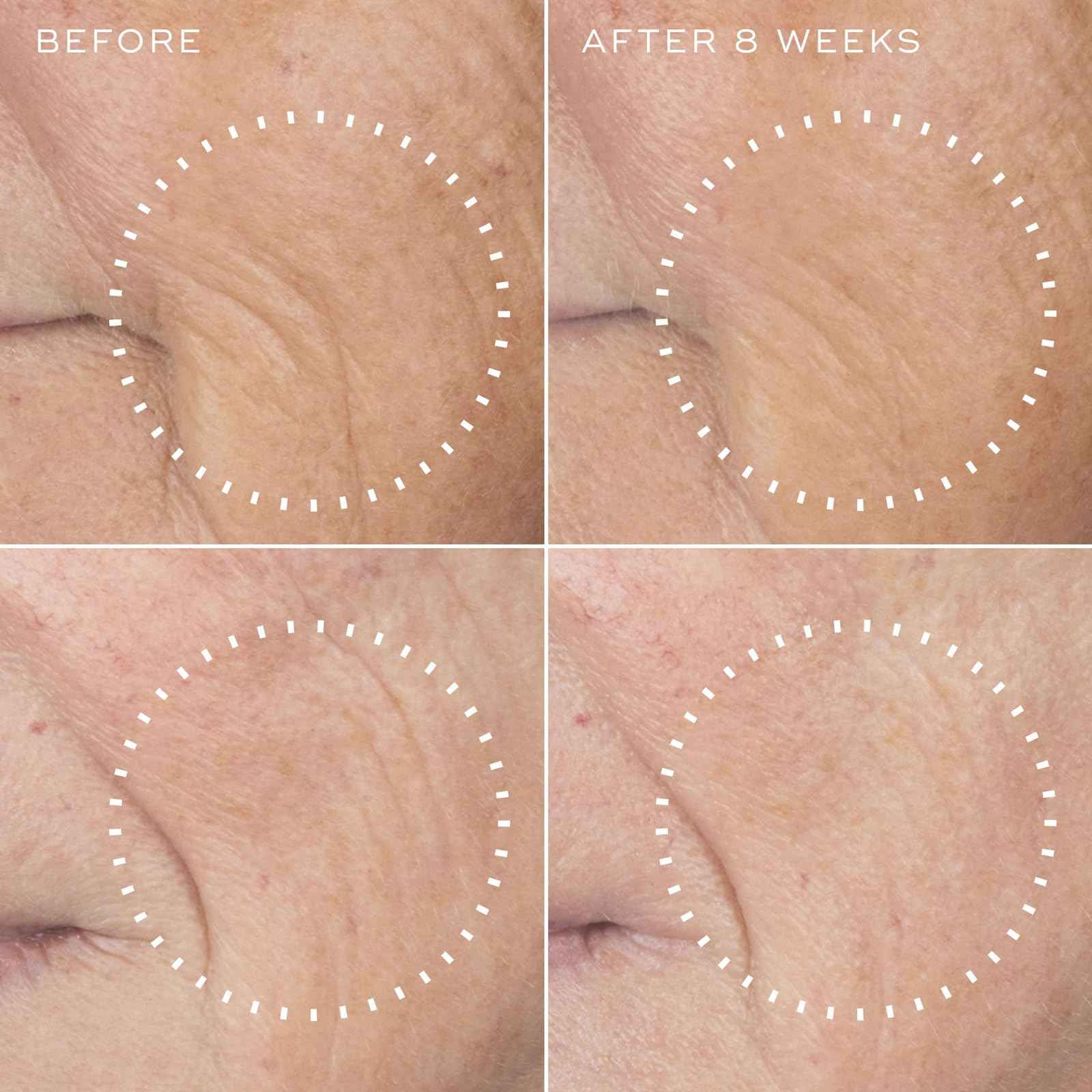 Medik8 Liquid Peptides Advanced MP - Peptide Serum - Face Serum for Wrinkle Reduction - Hydrating and Supports Collagen, Hyaluronic Acid - 1 oz