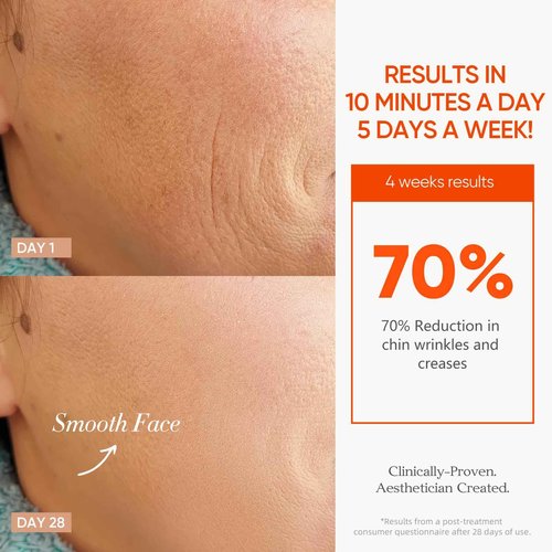 ESTANANA Cordless Red Light Therapy for Face, 7 Modes Led Face Mask Light Therapy with Remote, Near Infrared 880 Red Light Therapy Mask at Home, Wrinkle Reduction, Anti-Ageing, Black