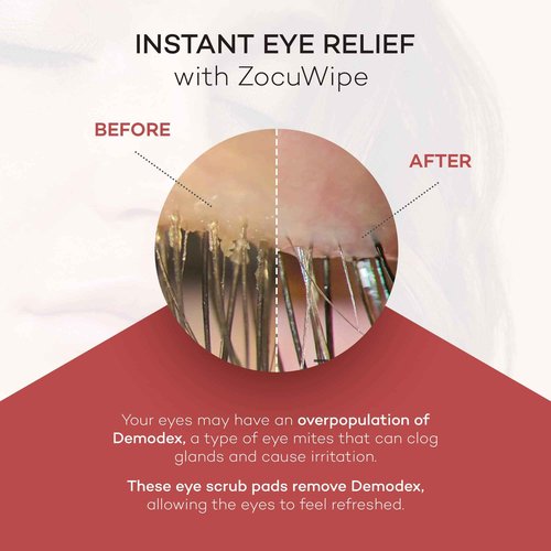 Zocuwipe Eyelid Wipes with Okra Complex - Eyelid Cleanser and Moisturizer Pads 30ct + Zocular ZocuFoam Eyelid Cleanser Bundle