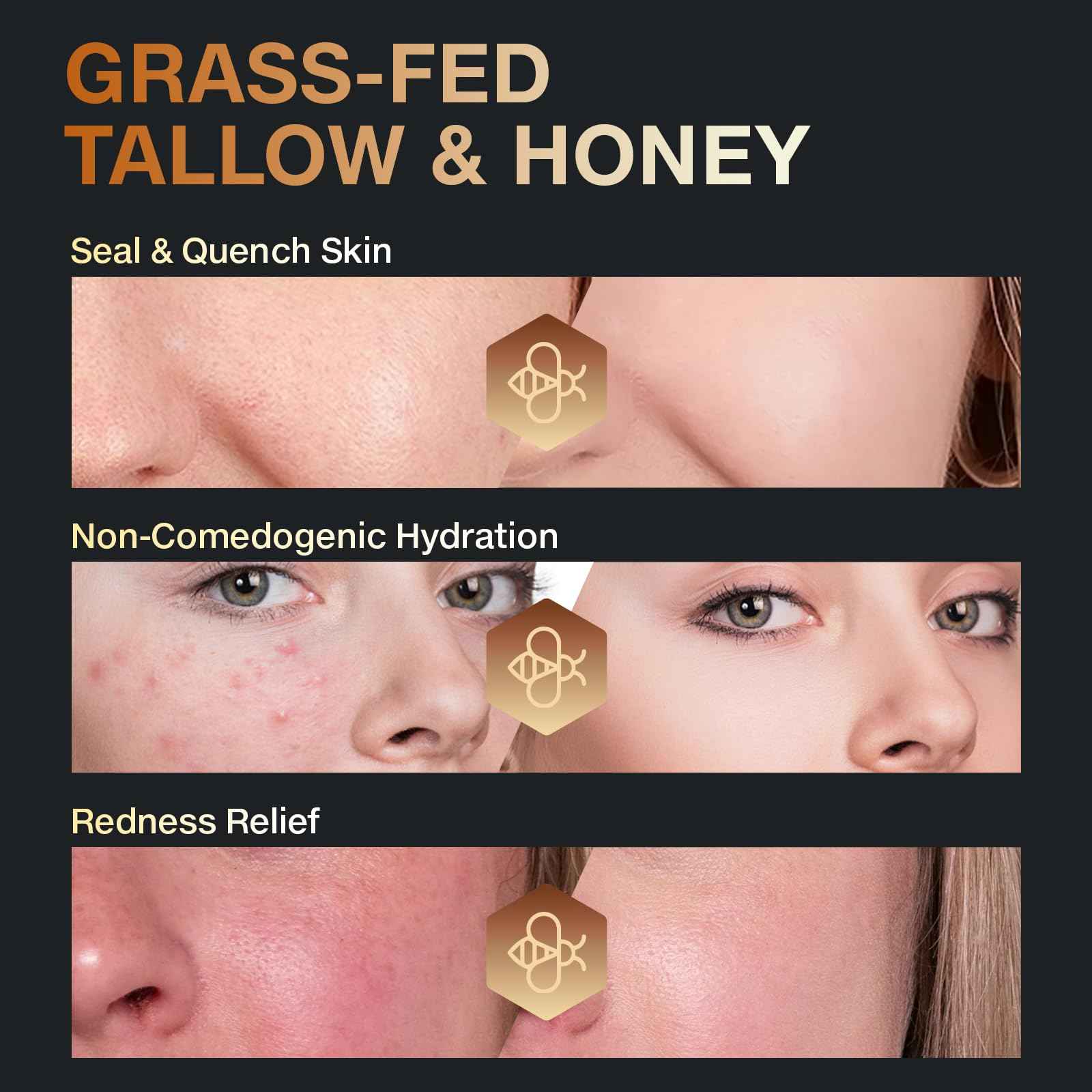 Lingmeier Beef Tallow for Skin, Tallow and Honey Balm, Organic Grass-Fed Beef Tallow for Skin with Raw Honey & Jojoba Oil, Whipped Moisturizer for Face & Body, Dry Skin Care, Non-Greasy