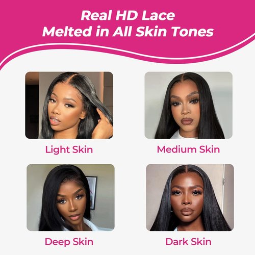 FalaFala SKINLIKE Real HD Lace 4x4 Closure Straight Human Hair Free Part Swiss HD Lace Melted Undetectable Serrated Edge Pre Plucked with Baby Hair Frontal Closures Only 18 Inch