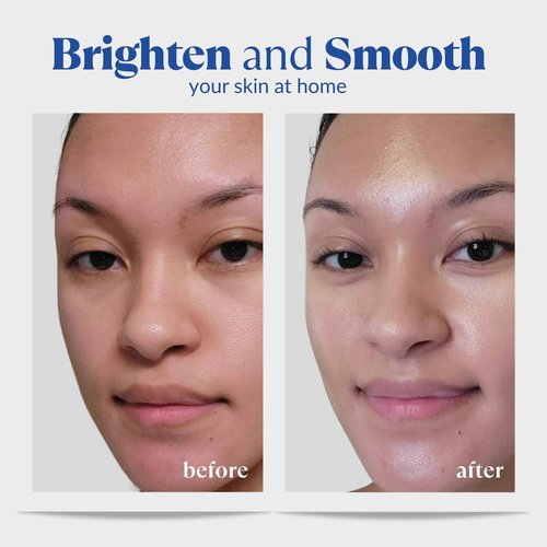 Aqua Gel Gentle Exfoliator + The Beauty 3-Step Skincare Kit Bundle