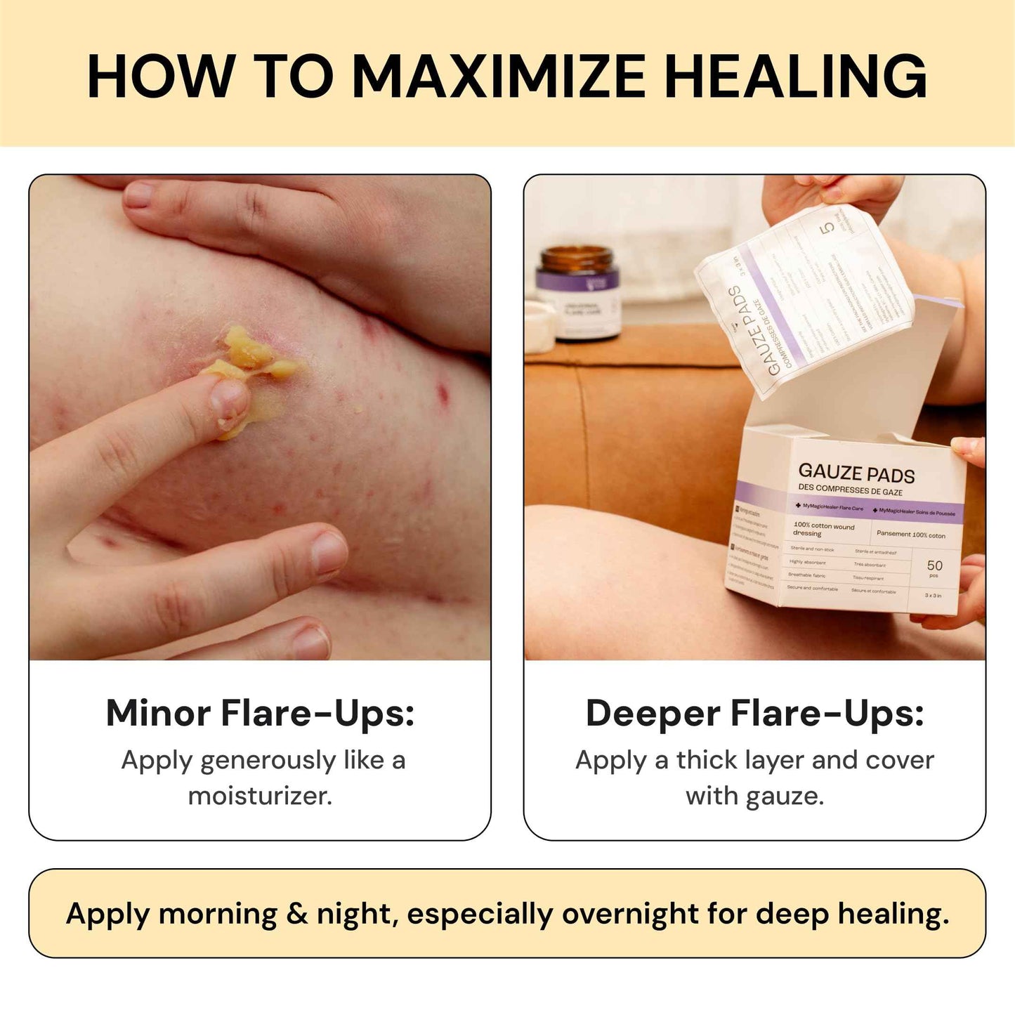 MyMagicHealer Comfort Flare Care | 1oz Collection of All-Natural Salves for Skin Flare-Ups Convenient Relief for Skin Flare-Ups, Acne, Boils, Muscle & Joint Discomfort – Perfect for Travel