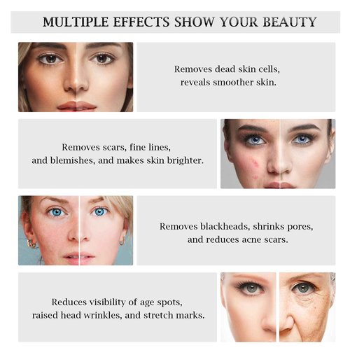 AIMENGXI 3 in 1 Diamond Microdermabrasion Machine, Professional Microdermabrasion Device with Vacuum Spray, Beauty Facial Skin Care Dermabrasion Equipment for Salon Personal Home Use