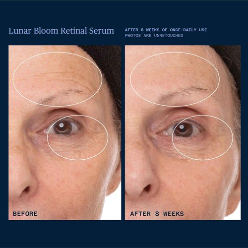 Ursa Major Lunar Bloom Retinal Serum | Potent & Gentle Facial Moisturizer | Smooth Fine Lines & Wrinkles | Vegan & Cruelty-Free | For All Skin Types | 1.0 ounce