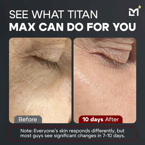 Man Labs Titan MAX Anti-Aging Face Serum for Men – Ultra Potency Mens Face Moisturizer – Men, Dark Spots, Wrinkles, Fine Lines – Vitamin C & E, 10% Niacinamide, Hyaluronic Acid – Unscented