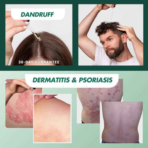 ABERA Alan Silver Serum – Botanical Hydrating Serum for Dry & Sensitive Skin & Herbal Extracts – Daily Moisturizer for Face, Body & Scalp – Fast Absorbing, Lightweight – 3 boxes