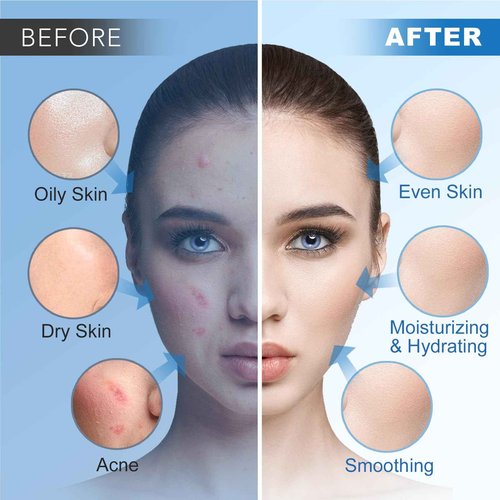 Angeland Jelly Mask for Facials Professional, Hydrating & Moisturizing Peel-Off Natural Gel Face Mask SkinCare, Professional Spa Use Jelly Face Masks, Deep Hydration & Glow 23 Fl Oz (6 Pack)