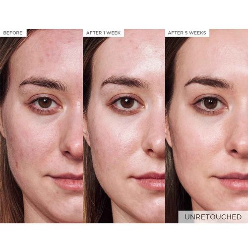 Glow Recipe Smooth + Soothe Duo - Strawberry Smooth AHA BHA Salicylic Acid & Avocado Ceramide Serum (30 ml/ea) - Korean Skincare for Glowing Skin