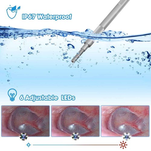 Digital Otoscope with 7 Inch IPS Screen, Hiacinto Ear Wax Removal Tool Camera, 3.9mm HD Ear Scope Otoscope with Light, Ear Camera and Wax Remover, Supports Photo Snap and Video Recording, 32GB Card