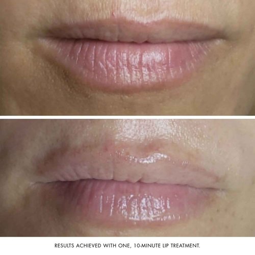 Bioelements Collagen Rehab - 1.7 fl oz - Face & Lip Mask for Aging Skin - Creates Instant Dewiness + Improves Fine Lines & Wrinkles - Vegan, Gluten Free - Never Tested on Animals