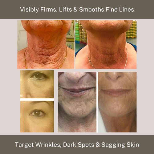 InfiniteAloe réparneu Gold Anti-Aging Formula, Neck Firming, Face Tightening, Anti Wrinkle Face Cream - Organic Aloe Powered with Collagen, Peptides & Retinyl - 0.5oz Jar