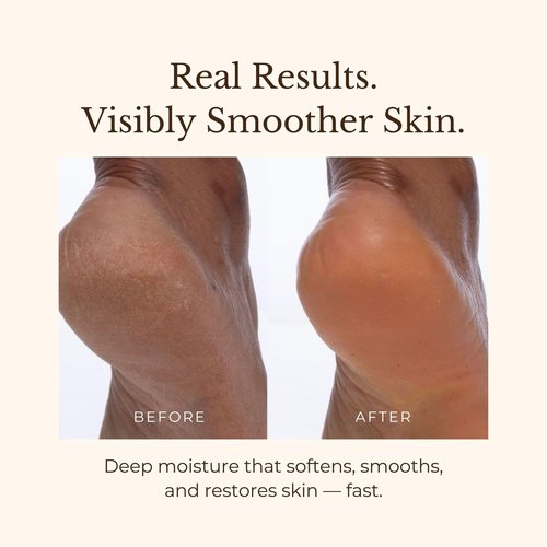 Juara - Candlenut Body Creme | Moisturizing Lotion | Dry Skin Hydration | Skin, Hands & Feet Cream | Soothing Skincare Balm | Cruelty Free, Paraben & Sulfate Free, Vegetarian | 7.5 oz (2-Pack)