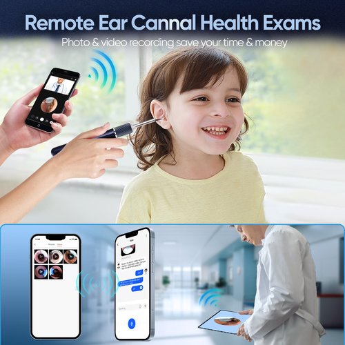 Ear Tweezers with Camera, Note5 Visual Ear Wax Removal Tool Camera with 10 Megapixel Otoscope, 3-in-1 Visual Earwax Cleaning Kit WiFi Ear Cleaning Kit, Ear Camera, Ear Otoscope Camera