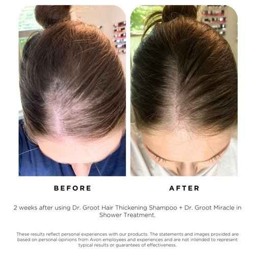 Dr. Groot Thicken & Smooth at Home and On The Go Bundle for Hair Loss, Korean Hair Care, With Biotin and Prebiotics, Clinically Proven to Improve Scalp Moisture