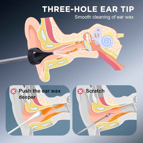 Ear Wax Removal Tool-Ear Cleaner-Ear Cleaning Kit, Safe & Effective Electric Triple Jet Stream Ear Cleaner with 6 Reusable Tips USB Rechargeable