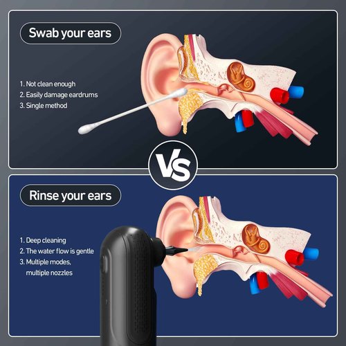 Raccomb Ear Wax Removal Tool, Ear Cleaner Earwax Removal, 4 Pressure Modes Rechargeable Ear Flush, Ear Irrigation Kit, Electric Ear Wax Remover with 10+2 Ear Tips