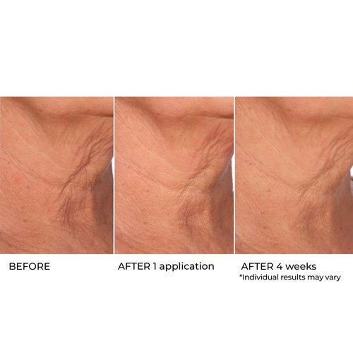 NassifMD Age Defying Neck & Décolleté Serum, Lifts and Firms Thin Neck Skin, Hydrates and Smooths