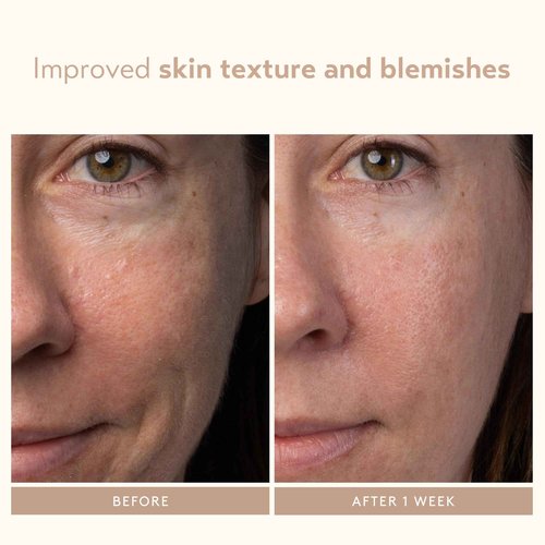 SHANI DARDEN SKIN CARE Lactic Acid Face Serum, Active Night Serum to Help with the Look of Radiant and Smooth Skin, Gentle But Powerful Face Exfoliator, 1.01 fl oz