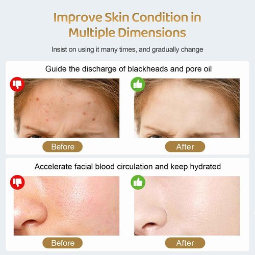 Professional Facial Steamer by Kingsteam - 2 in1 Face Steamer with 5X Magnifying Light Arm, Ozone Facial Steamer on Wheels, Nano Water Mist, High Volume Steam for Baber, Salon and Home use, White