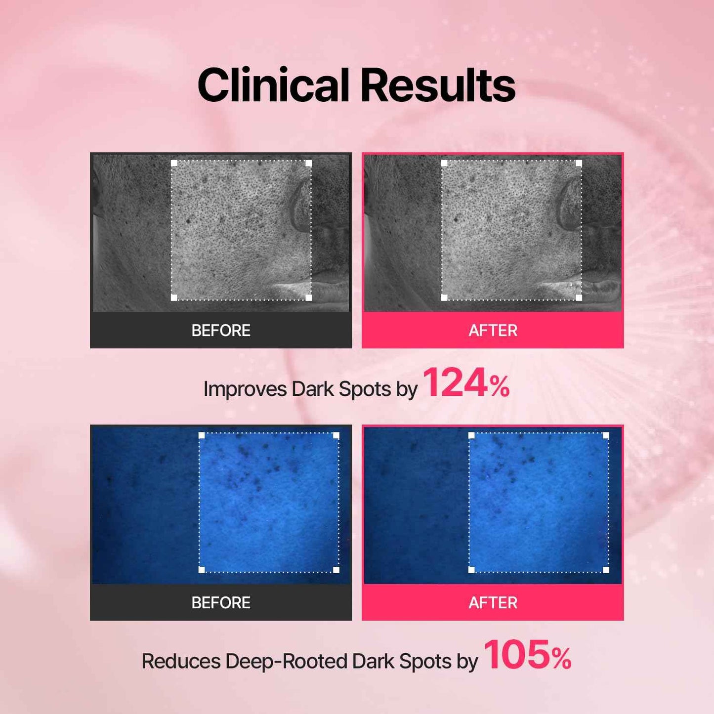 MEDITHERAPY Tranexamic Acid Skin Booster Cream 3.4 Fl Oz - 5% Niacinamide & 3% TXA Korean Face Moisturizer - Gentle Facial Serum Cream with Facial Device for Glass Skin - Radiant Complexion