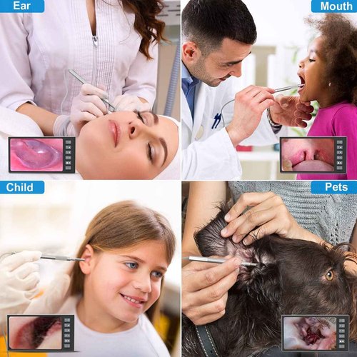 Digital Otoscope with 7 Inch IPS Screen, Hiacinto Ear Wax Removal Tool Camera, 3.9mm HD Ear Scope Otoscope with Light, Ear Camera and Wax Remover, Supports Photo Snap and Video Recording, 32GB Card