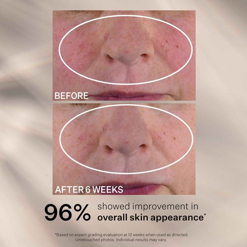 StriVectin Advanced Retinol Nightly Multi-Correct Serum