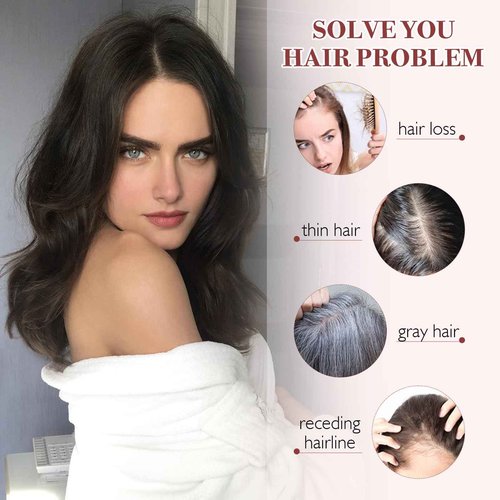 S-noilite Hair Toppers for Women 100% Real Human Hair, 10x12 Upgrade Base Natural Black Remy HairToppers for Women with no Bangs 10inch 35g #Natural Black