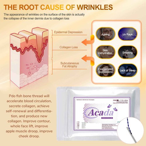 PHYMAT ACADA Pdo Threads for Face Lift Cog 18G100mm Pdo Fishbone Thread Bullet Blunt Cog Threads for Face Lift 20Pcs