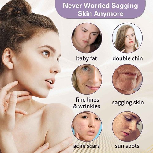 Elves Threads Lift for Face Whole Body Lifting/Screw Mono Threads for Eye lift/Protein Threads for Face/ 20pcs